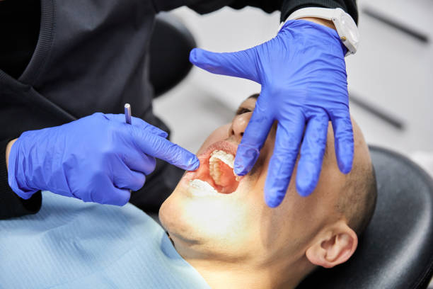 Best Emergency Treatment for Toothache in Camp Wood, TX